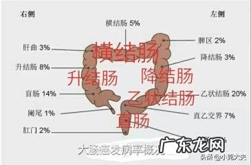 肠癌有什么前兆症状？