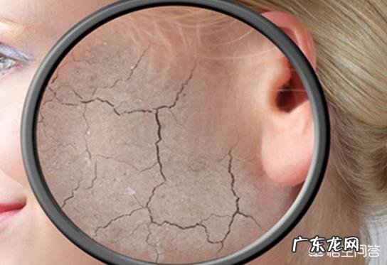 秋季皮肤干燥缺水怎么办？