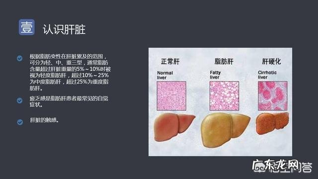 无氧运动对缓解脂肪肝有帮助吗
