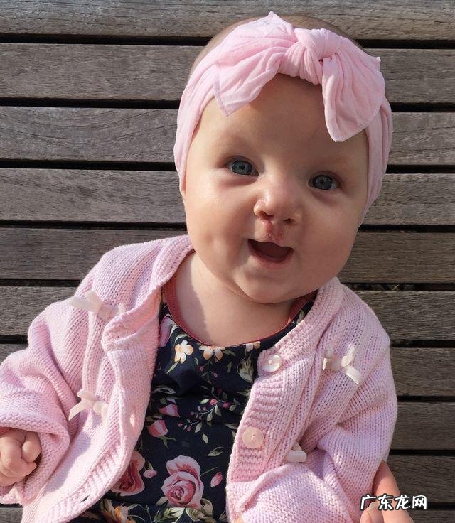 检查出孩子唇裂怎么办?