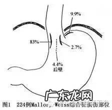 喝酒后吐血可能是什么原因?