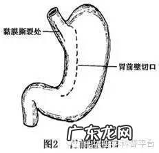 喝酒后吐血可能是什么原因?