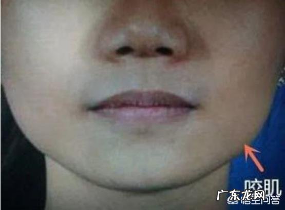 如何瘦脸?婴儿肥瘦脸?