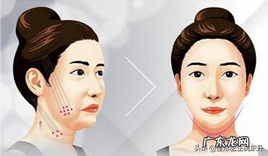 蛋白埋线原理,蛋白埋线术前术后注意事项