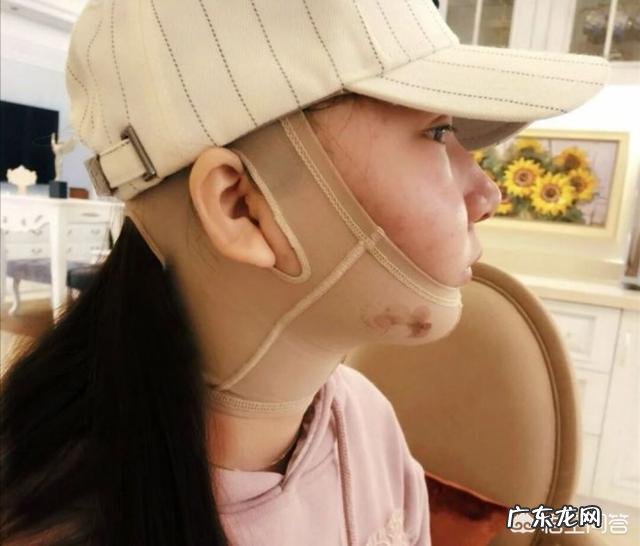 吸脂减肥适合哪些人?