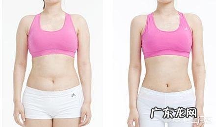 吸脂减肥适合哪些人?