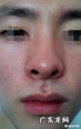 肝不好的人有什么共同点?