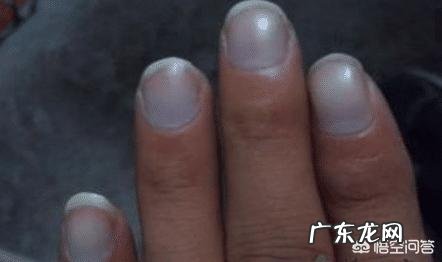 肝不好的人有什么共同点?