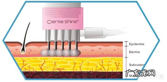 无针水光好还是有针水光好?