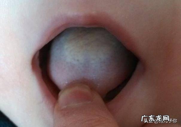 宝宝感冒了,如何缓解咳嗽?