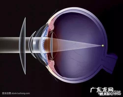 近视很严重怎么能够提高视力