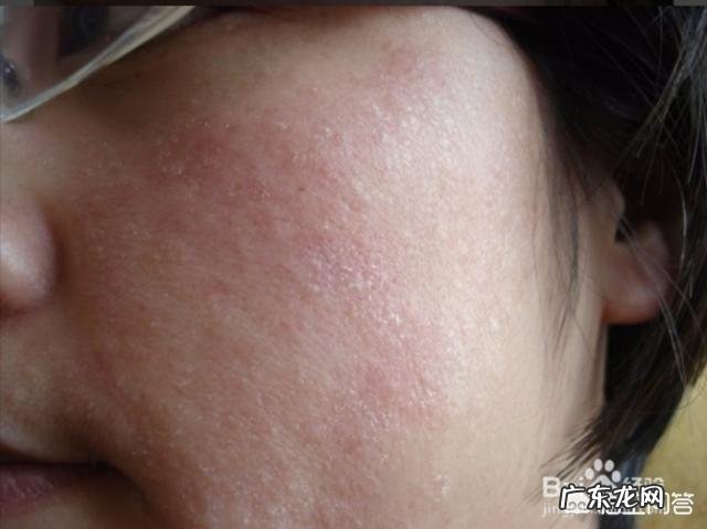 乳液哪款保湿补水的效果好呢？