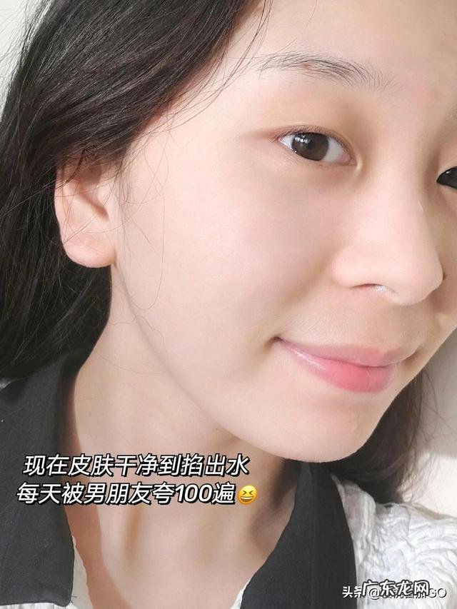 想问问真正有效的去斑产品或用什么方法去斑最好