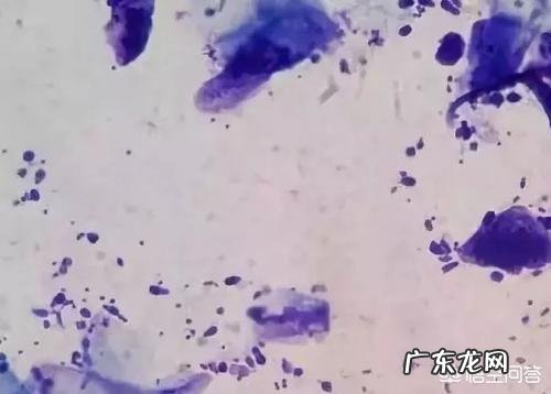 如何去头屑?头皮屑非常多,用过多种洗发露都没用,有啥好方法?