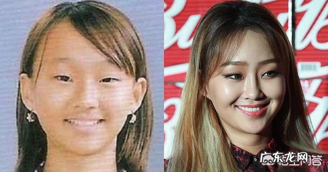 同样是整容，为什么主动承认自己整容的明星反而会获得观众好感？