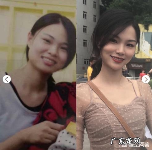 瘦脸针安全吗?注射瘦脸针后要注意什么?