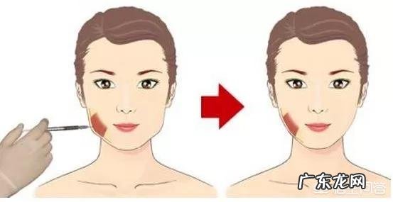 瘦脸针安全吗?注射瘦脸针后要注意什么?