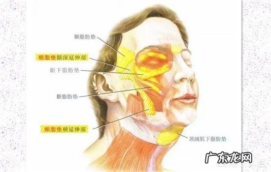 脸部抽脂怎么样?