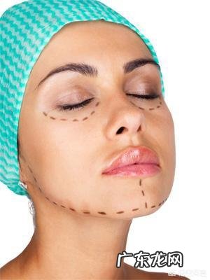 脸部抽脂怎么样?