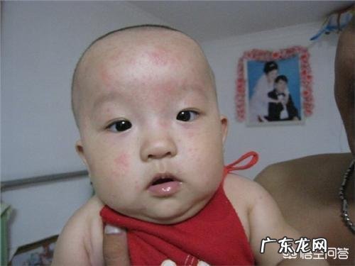 宝宝第一次发烧怎么办？