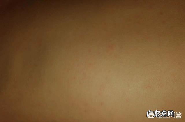 宝宝第一次发烧怎么办?