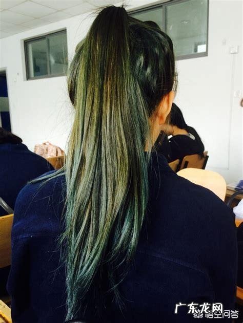 什么办法可以去头屑?