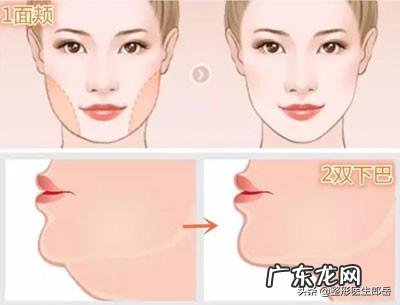 谁做过面部吸脂有用吗?