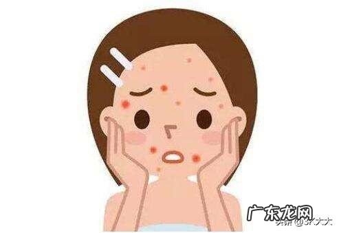 痘痘消了,但总留有痘印就很难受,还有什么专门祛痘印的护肤品好用?