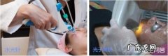 光子嫩肤好，还是水光针好？两者能同时做吗？