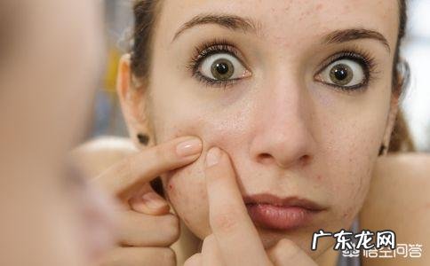 烟酰胺能祛痘印吗?