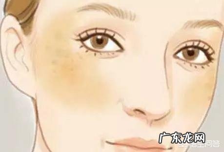 正确的祛斑观念和方法是什么