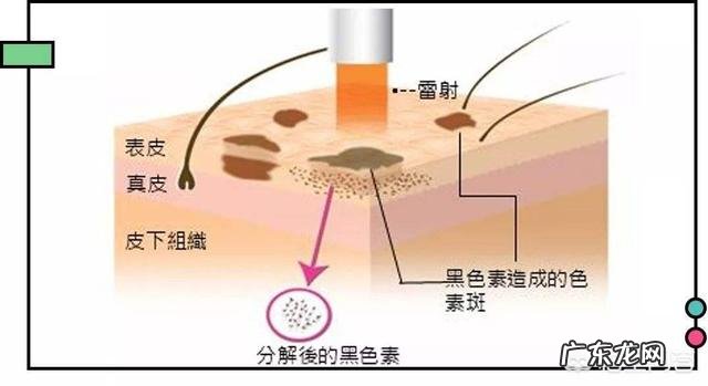 正确的祛斑观念和方法是什么