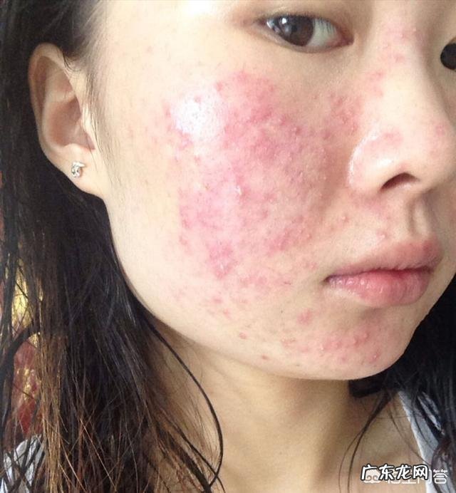 芦荟护肤有什么功效?
