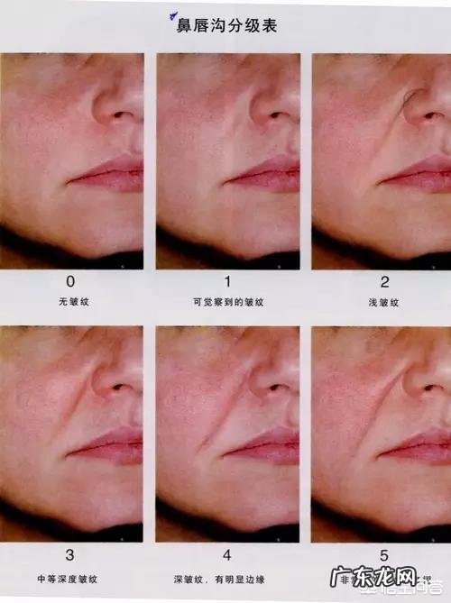 法令纹怎么除比较快？