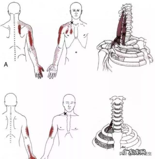 手臂酸疼,胳膊都抬不起来,手臂及肩膀疼得钻心刮骨,是什么原因?