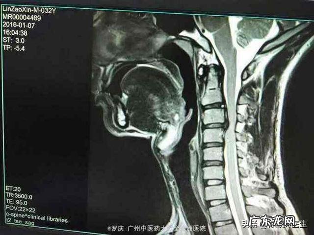 手臂酸疼,胳膊都抬不起来,手臂及肩膀疼得钻心刮骨,是什么原因?