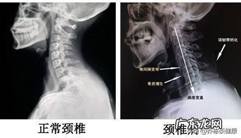 手臂酸疼,胳膊都抬不起来,手臂及肩膀疼得钻心刮骨,是什么原因?