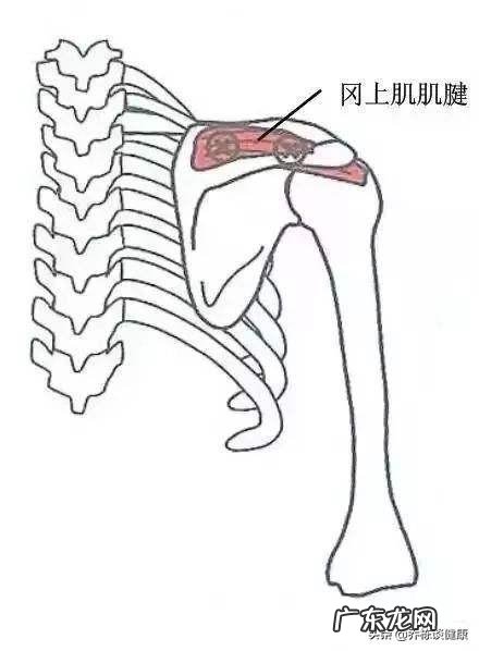 手臂酸疼,胳膊都抬不起来,手臂及肩膀疼得钻心刮骨,是什么原因?