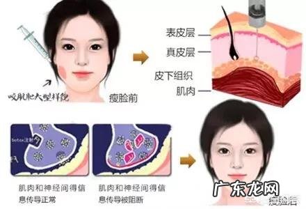 如何才能把脸瘦下去?