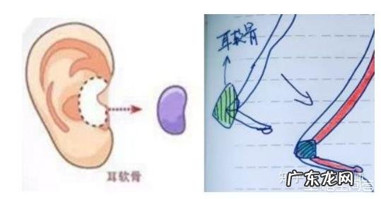 耳软骨隆鼻是永久的吗？会不会吸收后变成原来的样子？定型恢复后还会不会吸收？