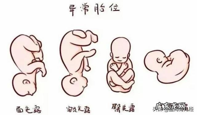 分娩方式是由哪些因素决定的？