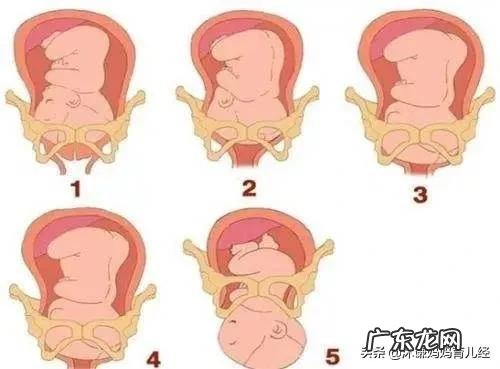 分娩方式是由哪些因素决定的？