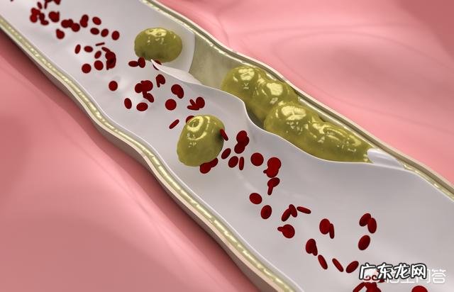 在生活中怎样才能够降低胆固醇的摄入?