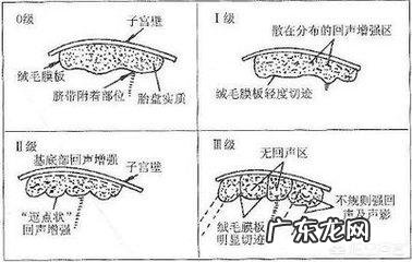 胎盘成熟度多少才是正常的?