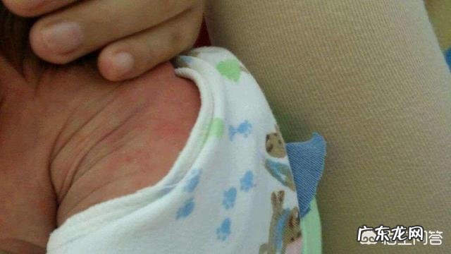 宝宝脸上出好多红点,是湿疹吗,湿疹是宝宝体内毒素吗,还是单纯的是热引起的?