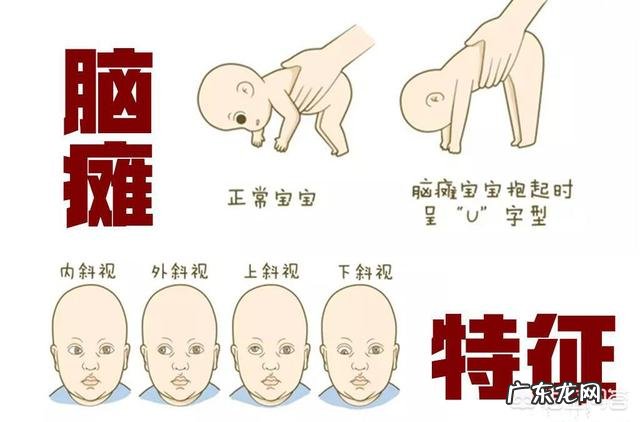 脑瘫在怀孕期检查不出来吗?