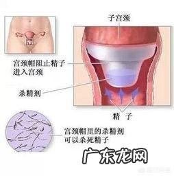 上环后要注意哪些事项？