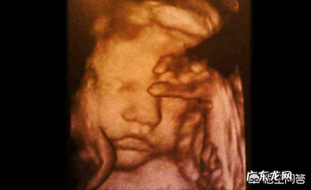 怀孕八个月，胎儿发育情况是怎样的？