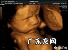 怀孕八个月,胎儿发育情况是怎样的?