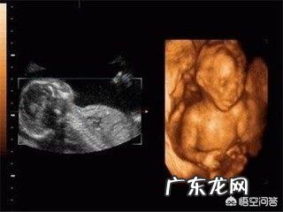 怀孕八个月,胎儿发育情况是怎样的?